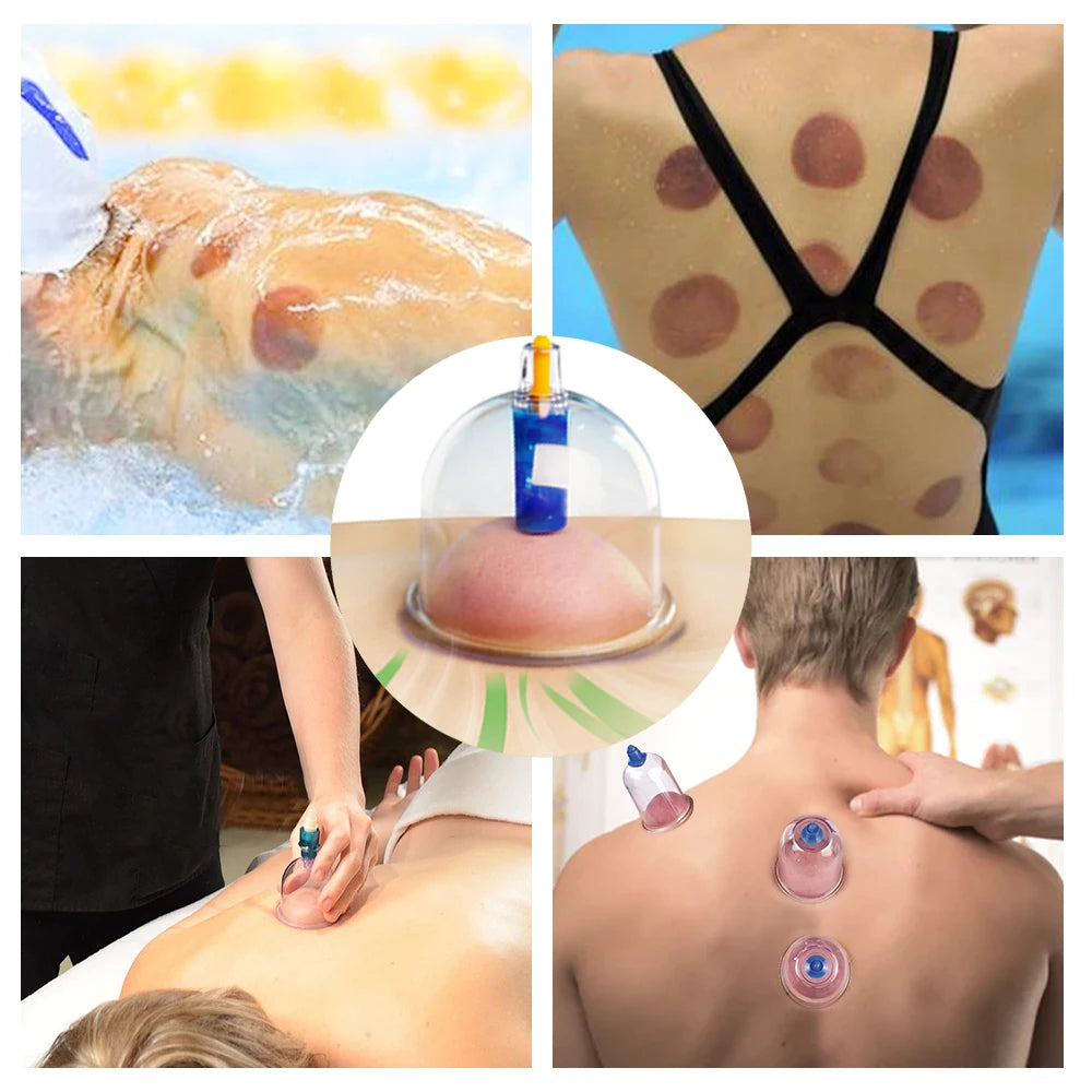 Rechargeable Electric Cupping Set – Magnetic Therapy Scraping Massager for Slimming, Pain Relief & Muscle Recovery