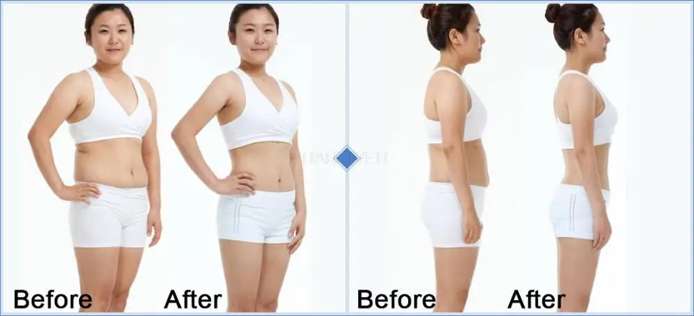 Far Infrared Slimming Belt Set – Waist & Leg Fat Burner Sauna Belt