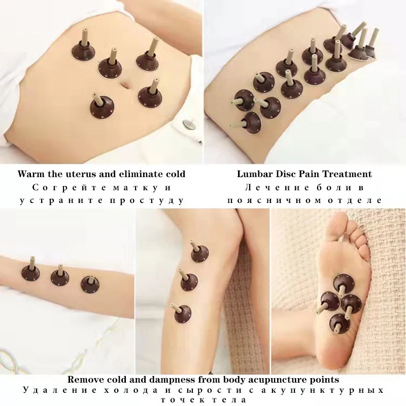 50Pcs Mini Moxa Stickers – Heating Acupuncture Moxibustion Therapy for Pain Relief