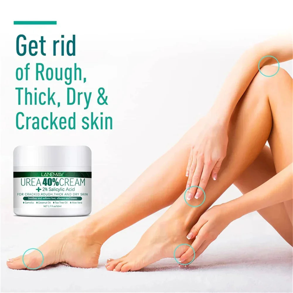 Herbal Anti-Crack Foot Cream – Heel Repair, Dead Skin Removal & Moisturizing Treatment