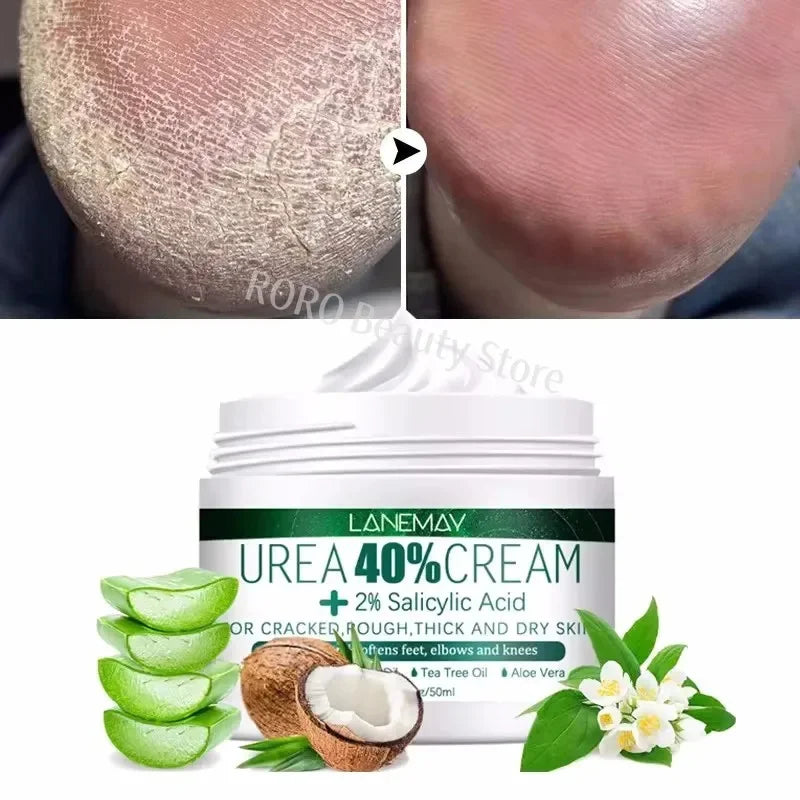Herbal Anti-Crack Foot Cream – Heel Repair, Dead Skin Removal & Moisturizing Treatment