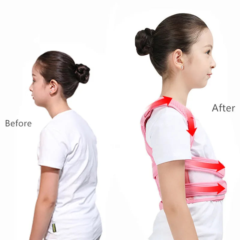 Posture Corrector Belt – Adjustable Shoulder & Waist Support for Adults & Kids