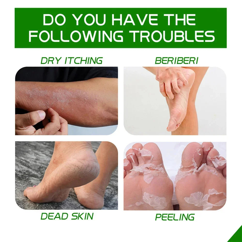 Herbal Anti-Crack Foot Cream – Heel Repair, Dead Skin Removal & Moisturizing Treatment