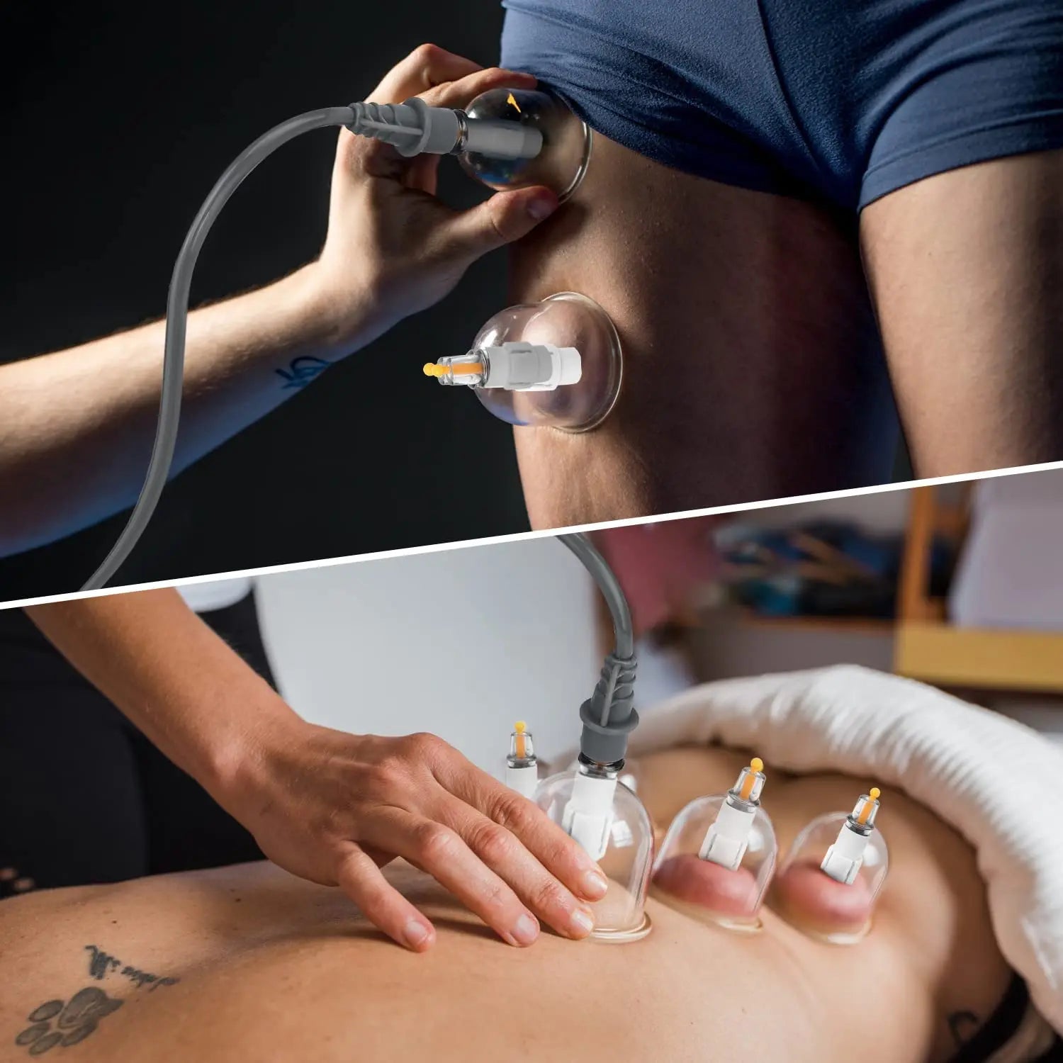 Vacuum Cupping Therapy Set – Chinese Suction Massage Jars for Slimming