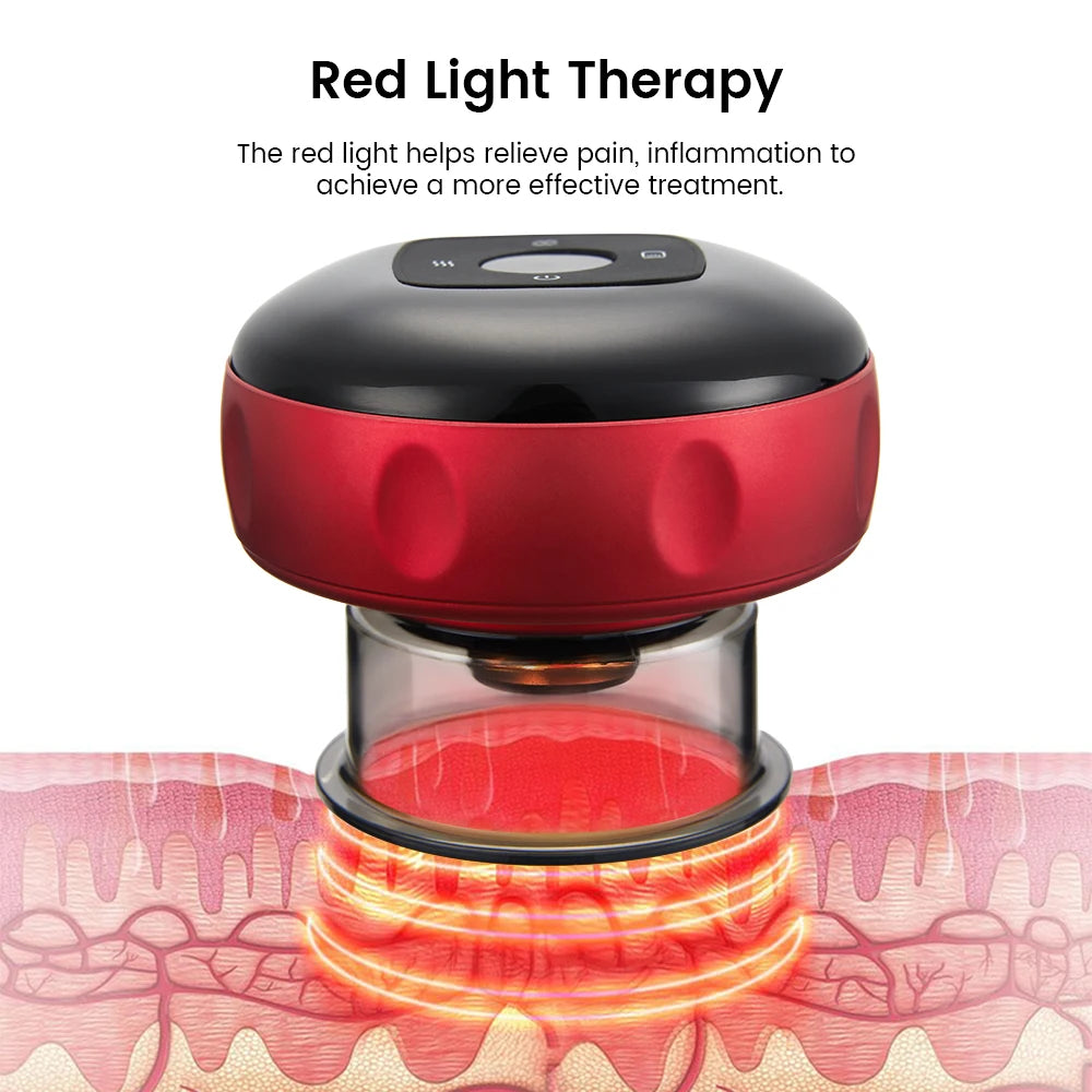 Vacuum Cupping Therapy Set – Chinese Suction Massage Jars for Slimming