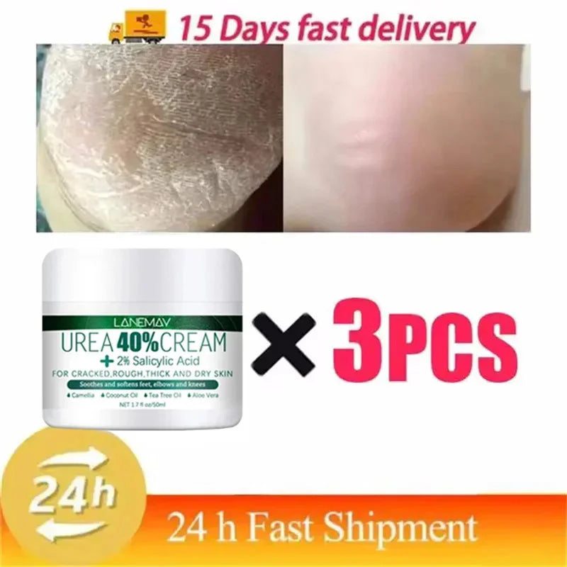 Herbal Anti-Crack Foot Cream – Heel Repair, Dead Skin Removal & Moisturizing Treatment